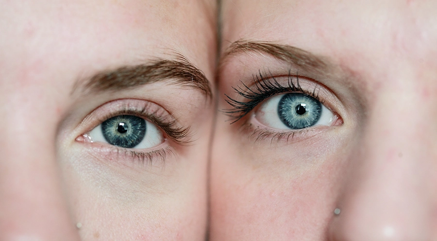 Göz Sağlığınızı Korumak İçin Dikkat Etmeniz Gerekenler
