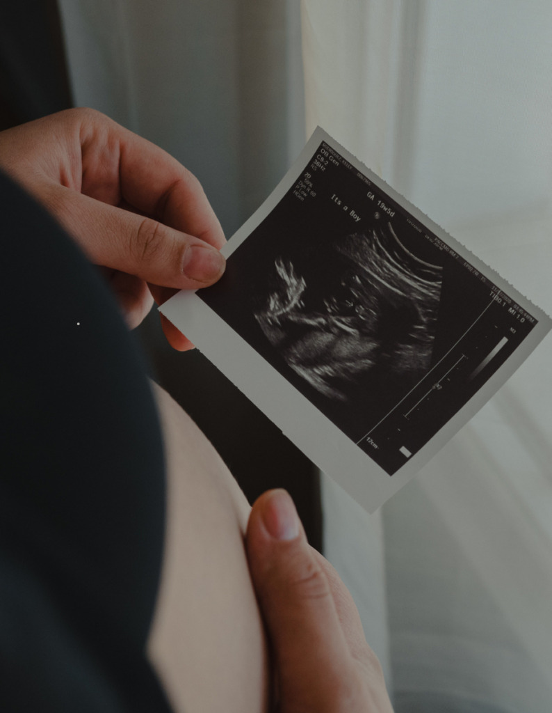 elinde gebelik ultrason görüntüsü tutan biri